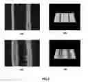 Fig. 06 - Method for manufacturing electrode of dye-sensitized solar cell and dye-sensitized solar cell having electrode thereof