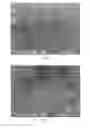 Fig. 06 - Method for preparing composite multilayer porous hollow membrane and device and product thereof