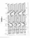 Fig. 02 - Extendible Stent Apparatus