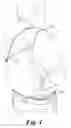 Fig. 02 - Method and system for an over the shoulder holster belt
