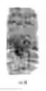 Fig. 09 - Finger sensing device including differential measurement circuitry and related methods