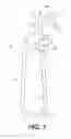 Fig. 02 - Line tightening device