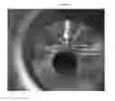 Fig. 53 - Mass spectometry using laserspray ionization