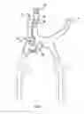 Fig. 07 - String loop tensioning pliers device and method of use