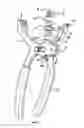Fig. 08 - String loop tensioning pliers device and method of use