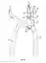 Fig. 09 - String loop tensioning pliers device and method of use