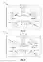 Fig. 02 - Bimetallic casting