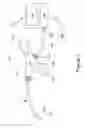 Fig. 02 - Endoscope and Angiograph System with Options for Advantages in Signal-to-Noise and Disposability