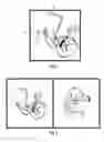 Fig. 07 - Method and apparatus for image orientation indication and correction