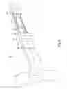 Fig. 08 - Non powered concepts for a wire frame of fluid filled lenses