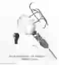 Fig. 02 - Trouble light advanced