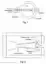 Fig. 02 - X-RAY BASED DENSITOMETER FOR MULTIPHASE FLOW MEASUREMENT