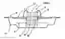 Fig. 01 - Speaker having center pleat