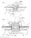 Fig. 02 - Speaker having center pleat