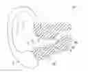 Fig. 01 - Adjustment and cleaning tool for a hearing assistance device