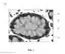 Fig. 02 - Digital image analysis using multi-step analysis