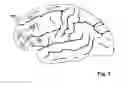 Fig. 02 - DEVICE AND METHOD FOR CEREBRAL LOCATION ASSISTANCE