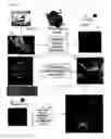 Fig. 04 - Method and system for intraoperative guidance using physiological image fusion