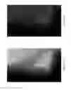 Fig. 06 - Method and apparatus for enhancing representations of micro-calcifications in a digital mammogram image