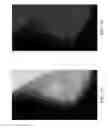 Fig. 07 - Method and apparatus for enhancing representations of micro-calcifications in a digital mammogram image