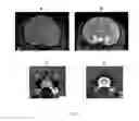 Fig. 08 - Methods for distributing agents to areas of brain