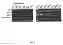 Fig. 06 - Method for obtaining female germline stem cells and uses thereof