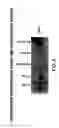 Fig. 07 - Methods and compositions for inhibiting the growth of hematopoietic malignant cells