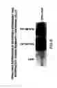 Fig. 08 - Methods and compositions for inhibiting the growth of hematopoietic malignant cells