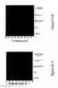 Fig. 30 - Methods and compositions for inhibiting the growth of hematopoietic malignant cells
