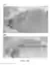 Fig. 19 - VECTOR FOR TREATING ALZHEIMER'S DISEASE