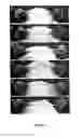 Fig. 02 - Use of 2,5-dihydroxybenzene derivatives for treating dermatitis