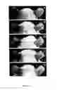 Fig. 07 - Use of 2,5-dihydroxybenzene derivatives for treating dermatitis