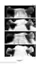 Fig. 08 - Use of 2,5-dihydroxybenzene derivatives for treating dermatitis