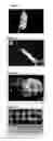 Fig. 03 - Particulate cadaveric allogenic cartilage system