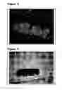 Fig. 04 - Particulate cadaveric allogenic cartilage system