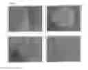 Fig. 06 - Functionalized calcium phosphate artificial bone and joint compositions and methods of use and manufacture