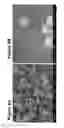 Fig. 10 - ION SUBSTITUTED CALCIUM PHOSPHATE COATINGS