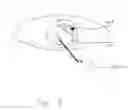 Fig. 03 - Apparatus and method for removing epithelium from the cornea