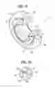 Fig. 03 - Functional element for attachment to a plastic component, a component assembly, a die button and method