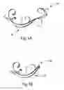 Fig. 06 - SANITARY TISSUE PRODUCTS AND METHODS FOR MAKING SAME