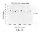 Fig. 16 - Biological specimen collection/transport compositions and methods