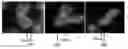 Fig. 01 - Characterization of chromosomal inversions using anti-parallel probes