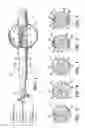 Fig. 02 - Brachytherapy device for facilitating asymmetrical irradiation of a body cavity
