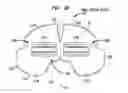 Fig. 04 - ORGAN PACKING DEVICE HAVING TRANSFORMABLE SUPPORT MEMBERS