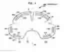 Fig. 06 - ORGAN PACKING DEVICE HAVING TRANSFORMABLE SUPPORT MEMBERS