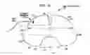 Fig. 02 - BOWEL PACKING DEVICE HAVING A TETHER