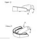 Fig. 09 - ROTICAM: An Orotracheal Guide with Camera