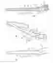 Fig. 02 - Stabilized elongate implantable vascular access device