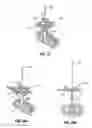 Fig. 22 - Lateral access system and method of use