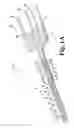 Fig. 02 - Electrochemical sensor having symmetrically distributed analyte sensitive areas